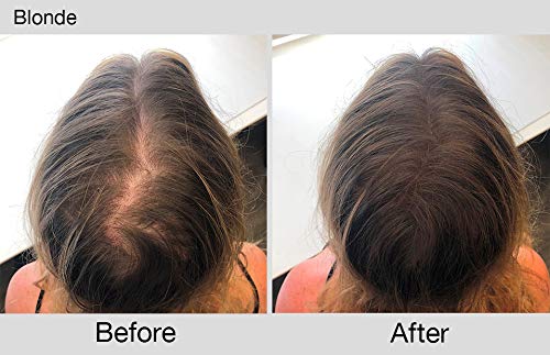 Joan Rivers Great Hair Day Fill-In Powder & Root Touch-Up Stick – Root Cover Up for Thinning Hair - Thicker and Fuller Hair – (Blonde)