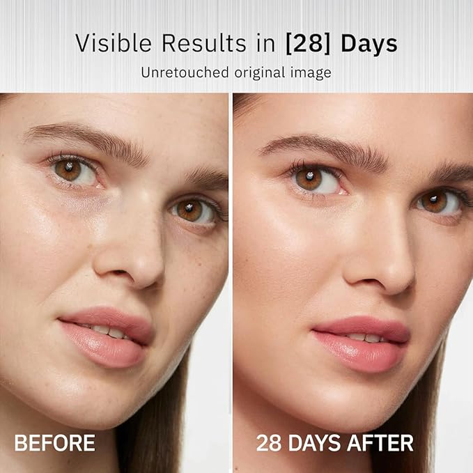 HKH Triple Vitamin C Serum Capsules for Face – Dark Spot Corrector, Anti-Aging & Hydrating Vitamin C with Camellia Extract & Vitamin E, Brightening Serum Reduces Fine Lines & Firms Skin, 28 Capsules