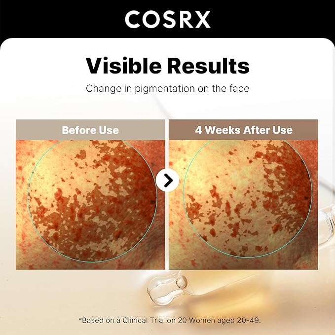 COSRX 2% Alpha Arbutin Discoloration Care Face Serum with Niacinamide, Glutathione & Tranexamic Acid, 1.7 fl oz – Serum for Face, Korean Skin Care