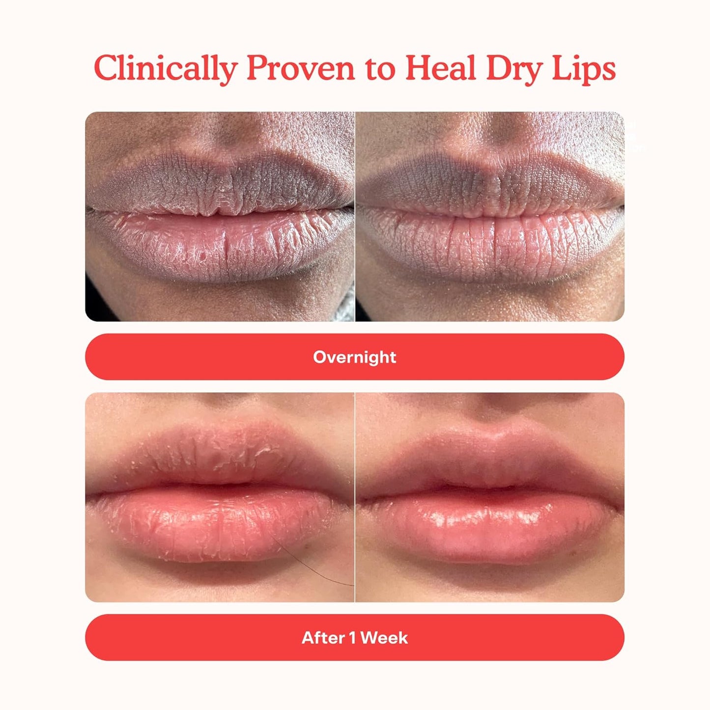 Tower 28 LipSoftie Hydrating Tinted Lip Treatment Balm, Moisturizing Lip Mask for Chapped Lips - Ube Vanilla Flavor, Sheer Burgundy Gloss