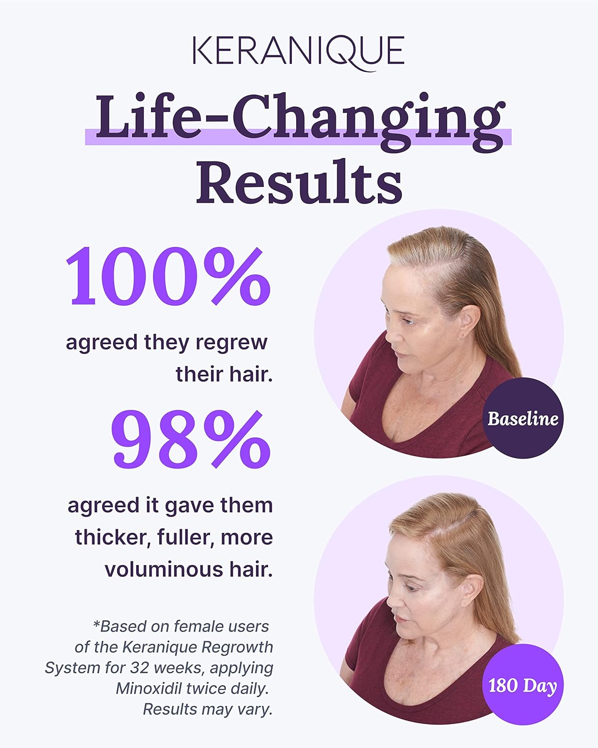Keranique Hair Regrowth Treatment for Women - 2% Minoxidil for Women Hair Growth & Thickening - Topical Solution Scalp Treatment for Hair Loss & Thinning w/Precision Spray Applicator - 4 Fl Oz